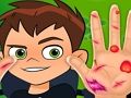 Xogo Ben10 Doutor de mans  en liña