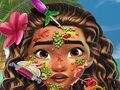 Xogo Moana Skin Doctor en liña Xogo Moana Skin Doctor en liña