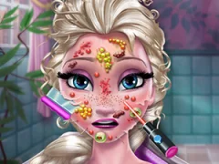 Xogo Ice Queen Skin Doctor en liña