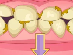 Xogo Bad Teeth Makeover en liña