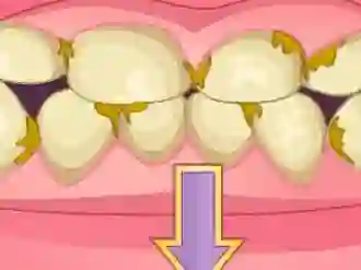 Xogo Bad Teeth Makeover en liña